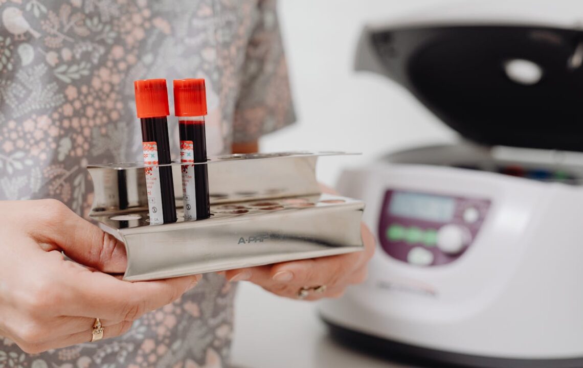 4 diseases that kill 80% of people – how to avoid them