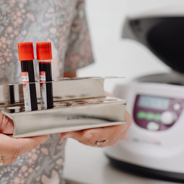 How to avoid a heart attack? A science-based guide