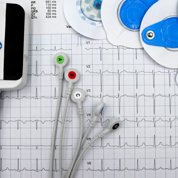 Małgorzata Kożuchowska eternally young – how does she take care of herself?