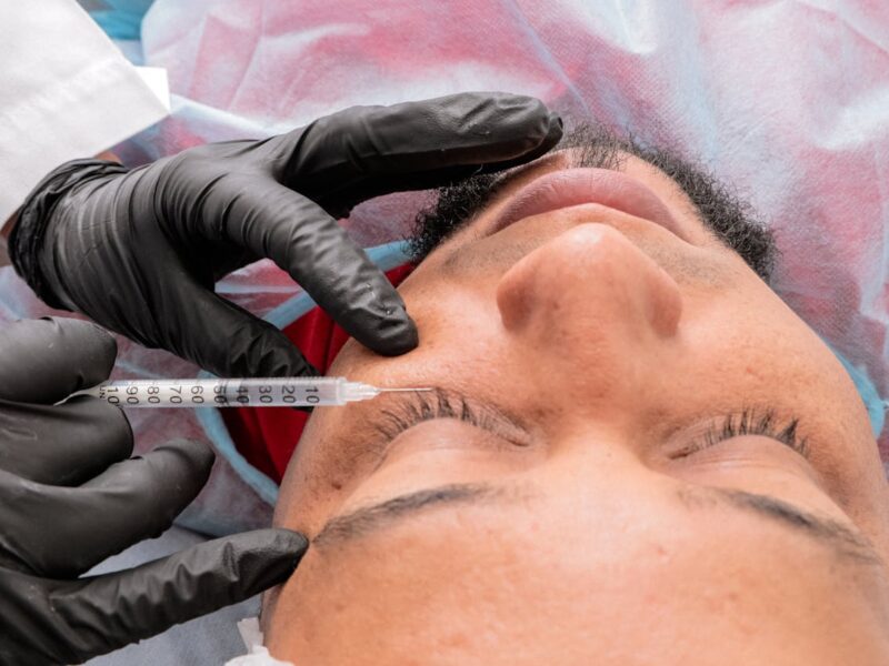 Krzysztof Ibisz – surgery or lifestyle?