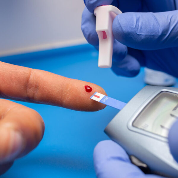 How to interpret blood tests for longevity – beyond the normal range