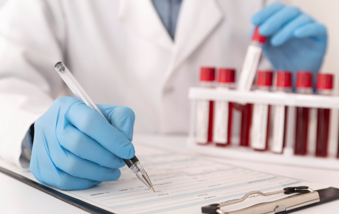 How to interpret blood tests for longevity – beyond the normal range