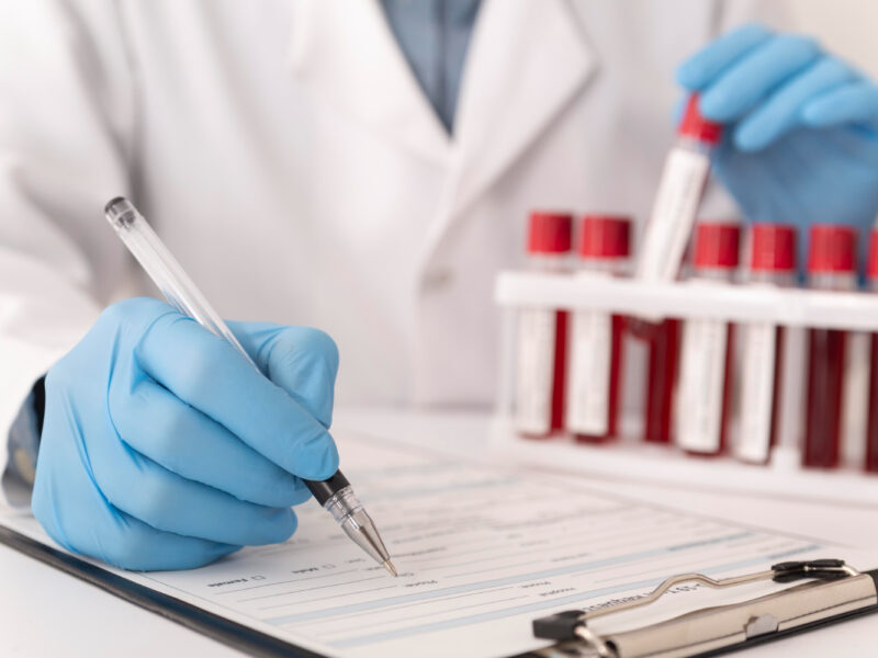 How to interpret blood tests for longevity – beyond the normal range