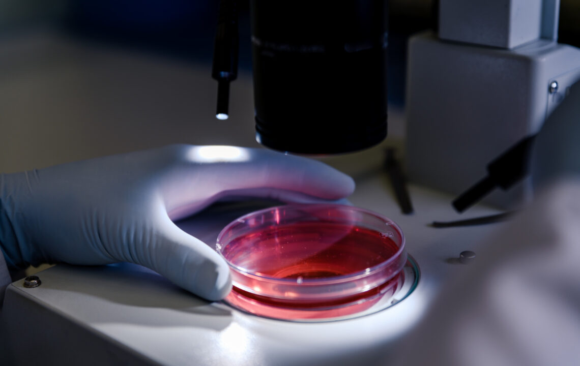 Zombie cells – what senescent cells are and how to remove them