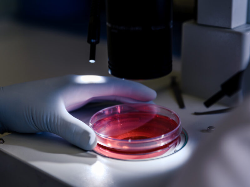 Komórki zombi – czym są komórki senescencyjne i jak je usunąć